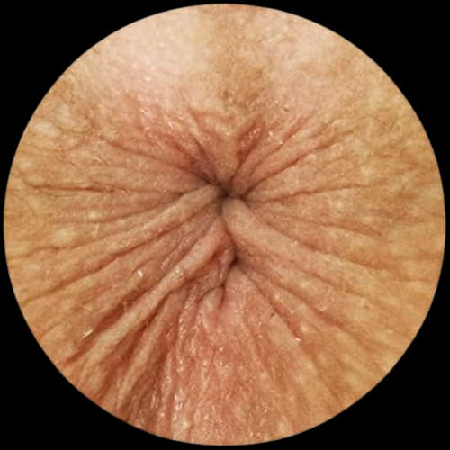 ANUS